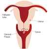 Uterine-or-cervix