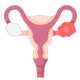 Uterus